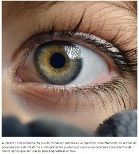 La IA consigue detectar el autismo infantil precoz mediante fotografas oculares con una exactitud del ...