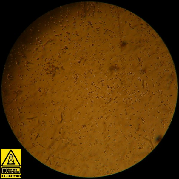 Foto 3/Paveando con el microscopio