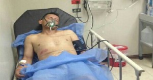 Fotgrafo Luis Daz fue brutalmente golpeado por la GN en Lara