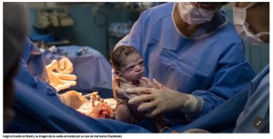La foto que dio la vuelta al mundo: la beba que naci enojada