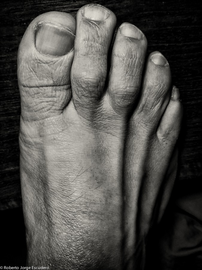 "Mi pie derecho" de Roberto Jorge Escudero
